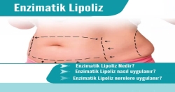 enzimatik lipoliz
