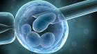 Anlaşmalı Tüpbebek(IVF) Merkezleri