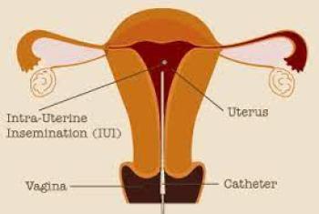 IUI - Intrauterine Insemination Clinics in Turkey